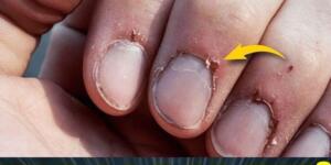 El ve Cilt Kırışıklıklarını Bitiren O D’oğal Y’öntem