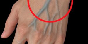 Görünür damarların varsa eğer öylesin demektir..