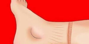 Kalbinizin düzgün çalışmadığını gösteren belirtiler. Not edin lazim olabilir..!