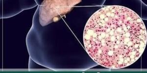 Şimdiye Kadar Bunu Öğrenseydik Hiç Yemezdik..