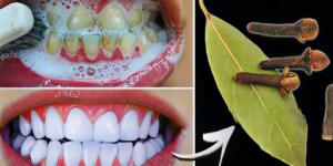 Sadece 2 dakikada tartarları çıkarın ve dişlerinizi beyazlatın. T’arifin tamamı