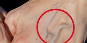 Görünür damarların varsa sende öylesin demektir..