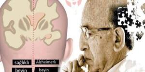 Alzheimer’a yakalanmamak için terk etmeniz gereken O 9 alışkanlık!!