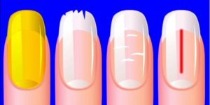 40 Yaşından Sonra Tırnağınızda Bu Çizgiler Varsa, Bu Açık Bir İ’şaretti