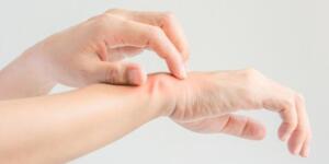 Kaşıntıyı Anında K’esen M’ucı-ze Bitki..