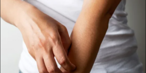 Zi’na Edenler Bu Hastalığa Mutlaka Yakalanır..