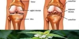 Dizleri iyileştiriyor! Kemikleri ve eklemleri yeniden doğmuş gibi yapıyor!