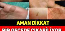 Sabah uyandıklarında elinde ya da ayağında kahverengi lekelerle karşılaşanların