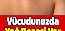 Vücudunuzda Yağ Bezesi Var Ise İş’te D’oğal T’edavisi