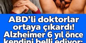 Abd’li doktorlar ortaya çıkardı T’arifi